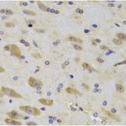 Ribosomal Protein S27 (RPS27) Antibody