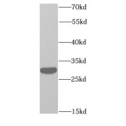 WB analysis of mouse brain tissue, using RPS3 antibody (1/1000 dilution).