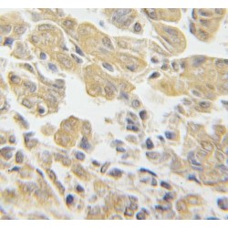 40S Ribosomal Protein S3 (RPS3) Antibody