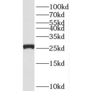 WB analysis of mouse brain tissue, using RPS3 antibody (1/1000 dilution).