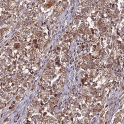 40S Ribosomal Protein S3 (RPS3) Antibody