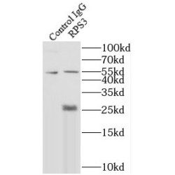 40S Ribosomal Protein S3 (RPS3) Antibody