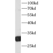 WB analysis of RAW 264.7 cells, using RPS3 antibody (1/8000 dilution).