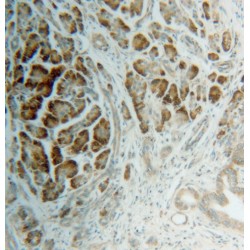 Ribosomal Protein S4, X-Linked (RPS4X) Antibody