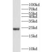 WB analysis of HeLa cells, using RPS5 antibody (1/600 dilution).