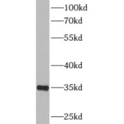 WB analysis of mouse liver tissue, using RPS6 antibody (1/1000 dilution).