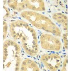 Ribosomal Protein S6 Kinase Like 1 (RPS6KL1) Antibody