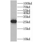 WB analysis of mouse liver tissue, using RPS8 antibody (1/600 dilution).