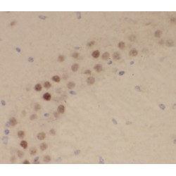 Ras Related GTP Binding B (RRAGB) Antibody