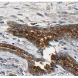 Ras-Related Protein R-Ras (RRAS) Antibody