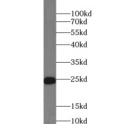 WB analysis of human spleen tissue, using RRAS antibody (1/500 dilution).