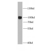 WB analysis of HeLa cells, using RRM1 antibody (1/1000 dilution).