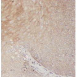 Ribonucleoside-Diphosphate Reductase Subunit M2 (RRM2) Antibody