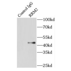 Ribonucleoside-Diphosphate Reductase Subunit M2 (RRM2) Antibody