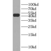 WB analysis of K-562 cells, using RRM2 antibody (1/200 dilution).