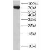 WB analysis of HeLa cells, using RRN3 antibody (1/600 dilution).