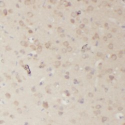 Ribosomal RNA Processing 7 Homolog A (RRP7A) Antibody