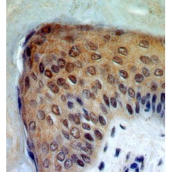 Ribosomal RNA Processing 8, Methyltransferase, Homolog (Yeast) (RRP8) Antibody