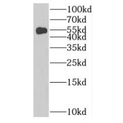 WB analysis of human brain tissue, using RRP8 antibody (1/1500 dilution).