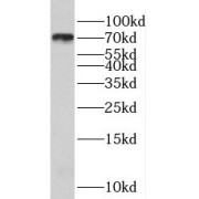 WB analysis of human brain tissue, using RSPH3 antibody (1/600 dilution).