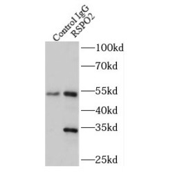 R-Spondin 2 (RSPO2) Antibody