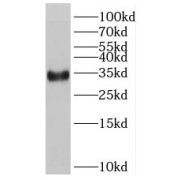 WB analysis of mouse brain tissue, using RSPO2 antibody (1/3000 dilution).