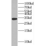 WB analysis of mouse placenta tissue, using RSU1 antibody (1/300 dilution).