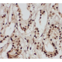 RNA Polymerase-Associated Protein RTF1 Homolog (RTF1) Antibody