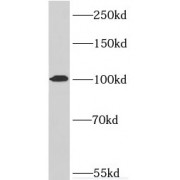 WB analysis of HeLa cells, using RTF1 antibody (1/300 dilution).