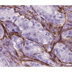 Rhotekin (RTKN) Antibody