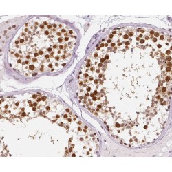 Rhotekin 2 (RTKN2) Antibody