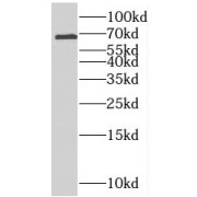 WB analysis of HL-60 cells, using RTKN2 antibody (1/800 dilution).