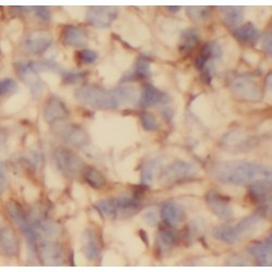 Reticulon 3 (RTN3) Antibody