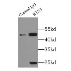 Reticulon 3 (RTN3) Antibody