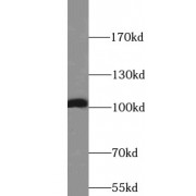 WB analysis of HeLa cells, using RTN3 antibody (1/500 dilution).