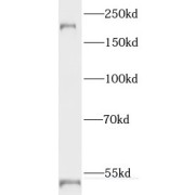 WB analysis of A375 cells, using RTN4 antibody (1/1000 dilution).