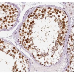 Rubicon (RUBCN) Antibody