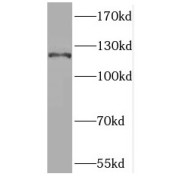 WB analysis of mouse liver tissue, using KIAA0226 antibody (1/1000 dilution).