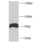 WB analysis of mouse lung tissue, using RUFY1 antibody (1/1200 dilution).