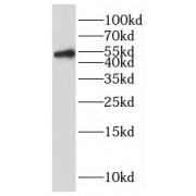 WB analysis of Jurkat cells, using RUNX1 (middle) antibody (1/2500 dilution).