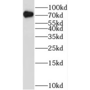 WB analysis of HepG2 cells, using RUNX1T1 antibody (1/600 dilution).