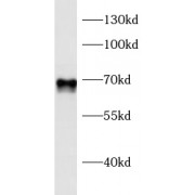 WB analysis of ROS1728 cells, using RUNX2 antibody (1/600 dilution).