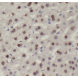 RuvB-Like 1/Pontin 52 (RUVBL1) Antibody