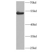 WB analysis of K-562 cells, using RUVBL2 antibody (1/1000 dilution).