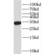 WB analysis of HeLa cells, using RWDD1 antibody (1/500 dilution).
