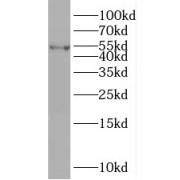 WB analysis of MCF7 cells, using RXRA antibody (1/600 dilution).