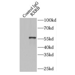 Retinoic Acid Receptor RXR-Beta (RXRB) Antibody