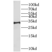 WB analysis of K-562 cells, using RYBP antibody (1/500 dilution).