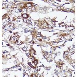 Protein S100-A10 (S100A10) Antibody