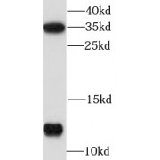 WB analysis of HeLa cells, using S100A10 antibody (1/1000 dilution).